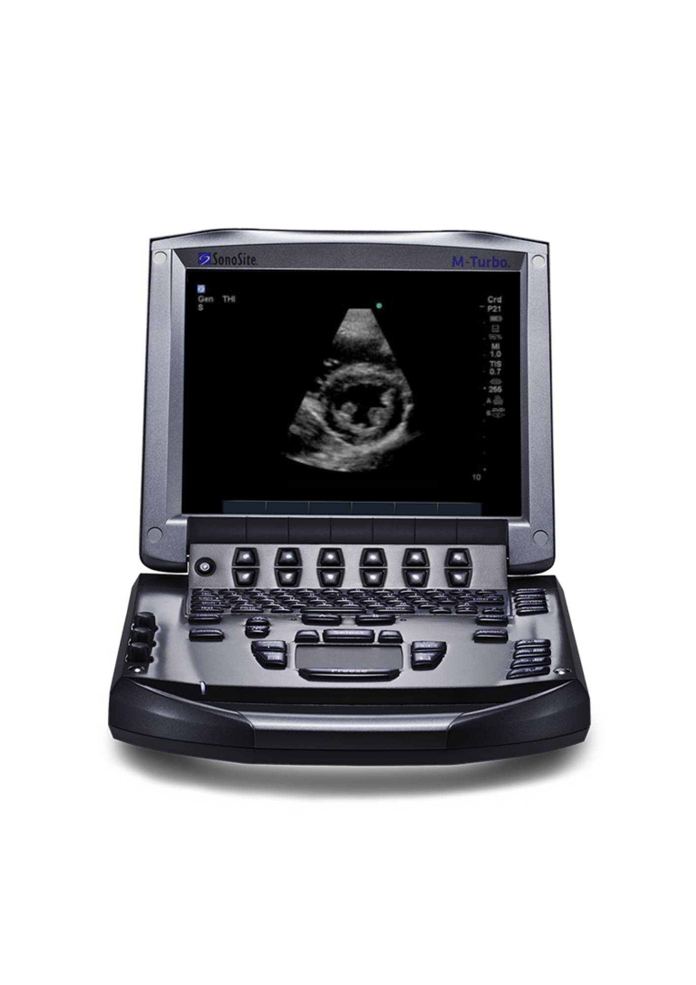 M-TURBO SONOSITE M-TURBO SONOSITE